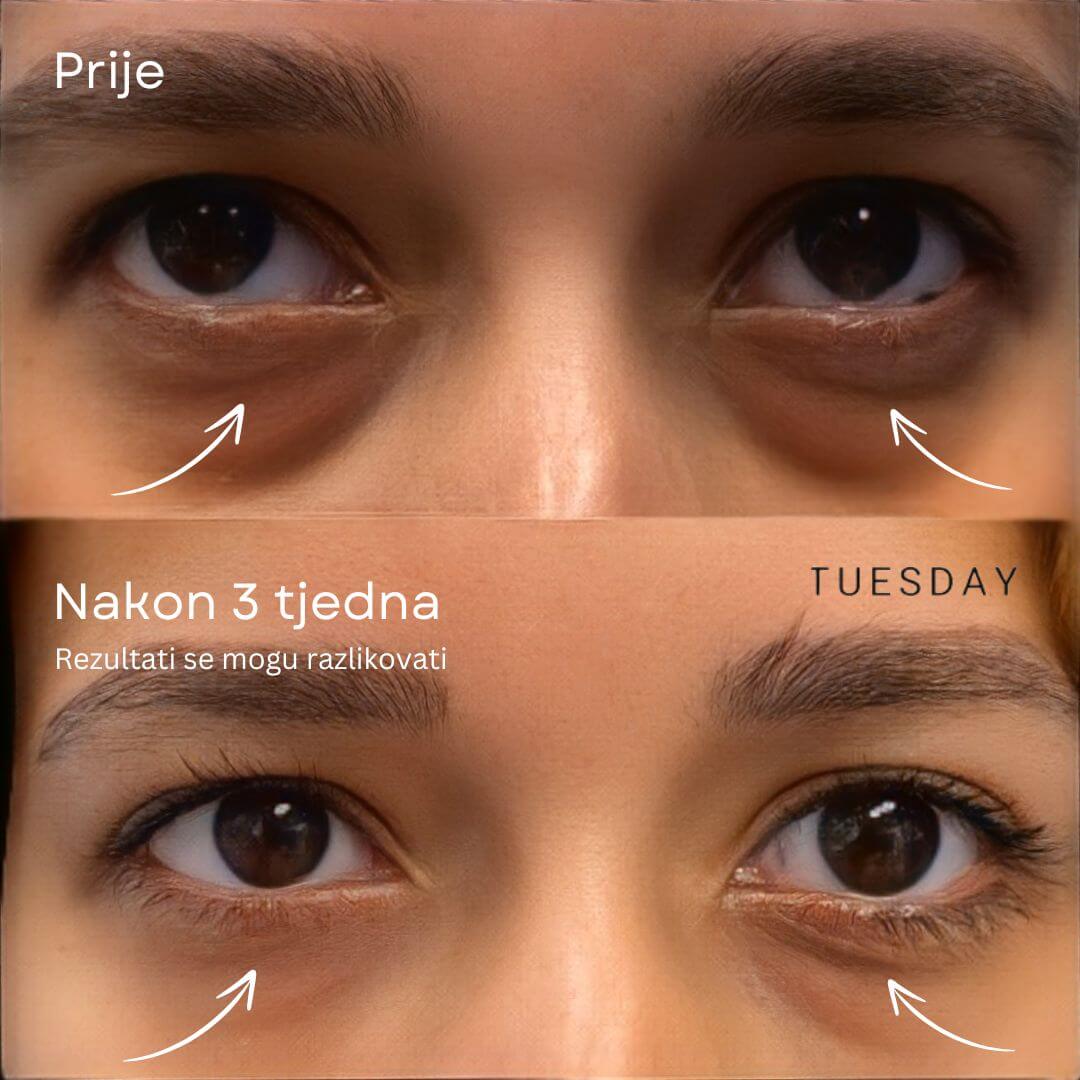 GlowLift Retinol Eye Stick