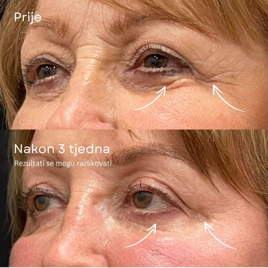 24K ZLATNI ANTI-AGING SERUM