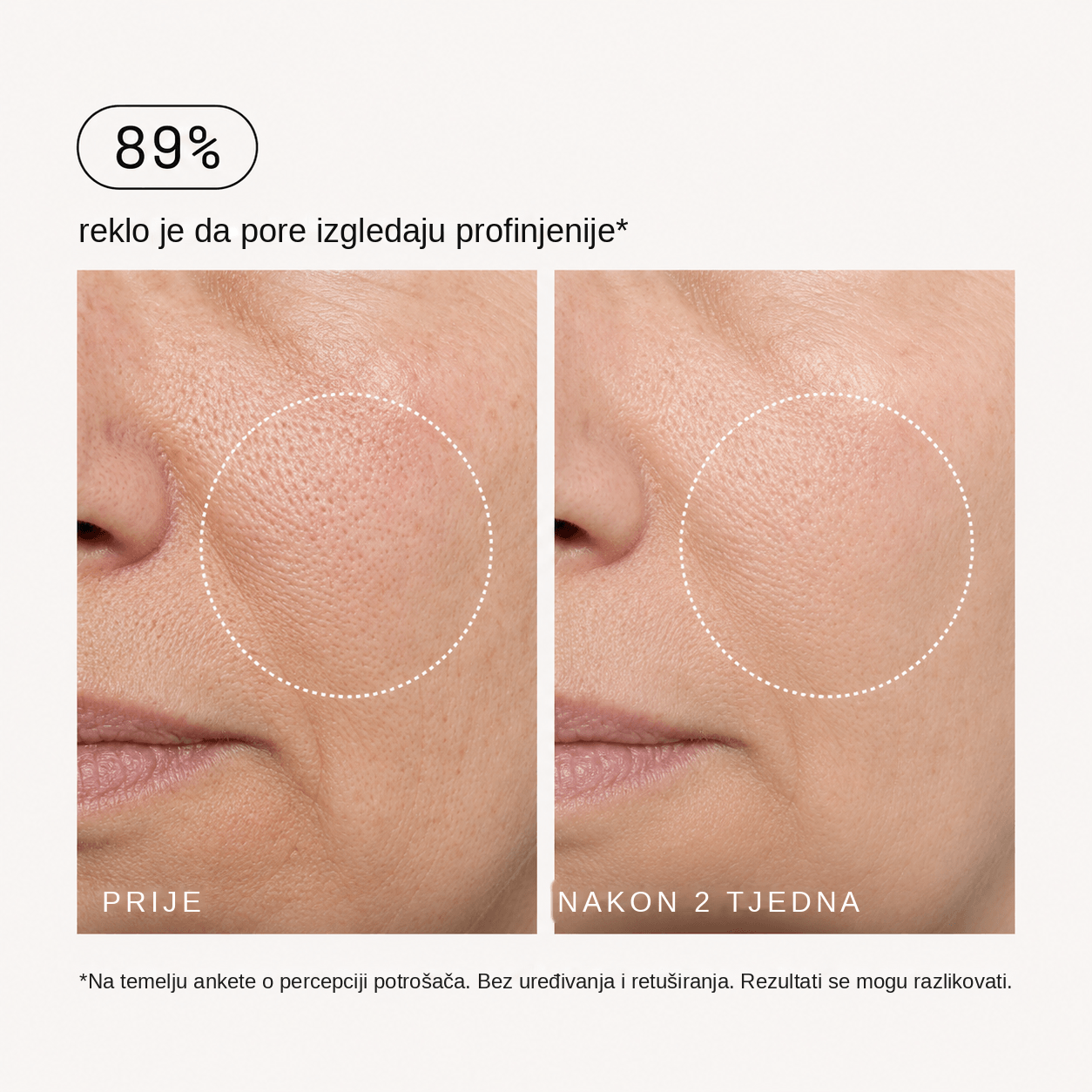 Retinalni učvršćujući serum