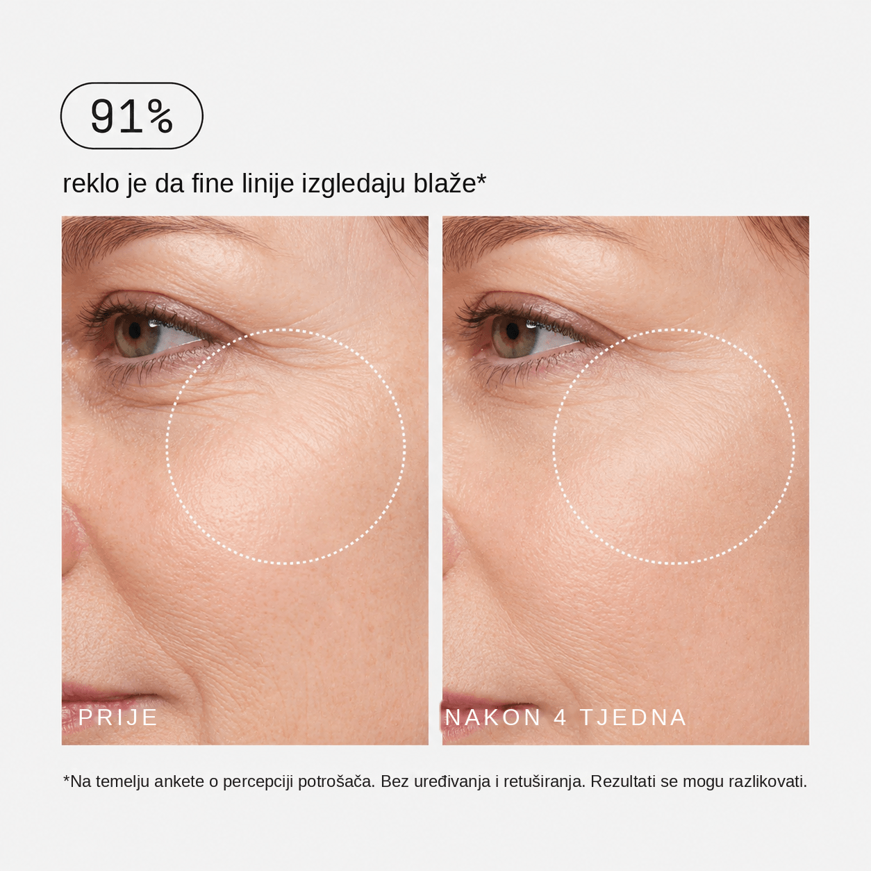 Retinalni učvršćujući serum